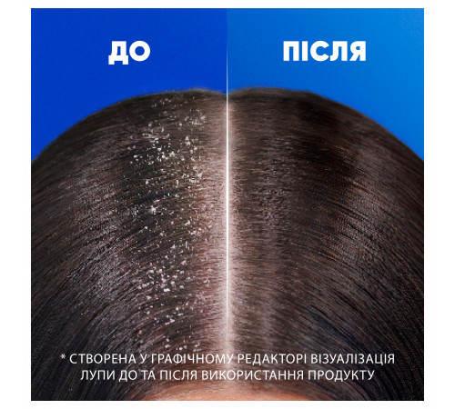 Шампунь проти лупи Head & Shoulders Гладке та шовковисте волосся 250 мл