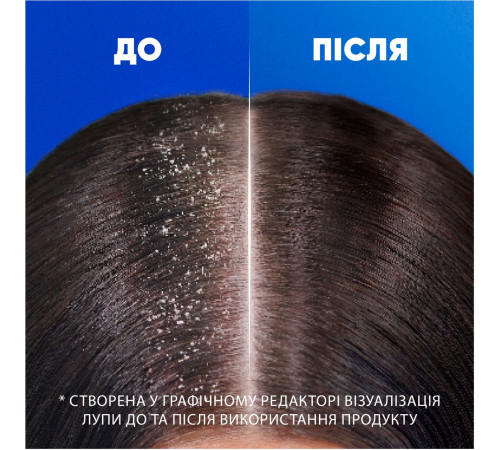 Шампунь Head & Shoulders 2в1 Цитрусовая свежесть 330 мл