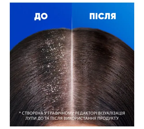 Шампунь против перхоти Head & Shoulders Глубокое увлажнение волос 250 мл Шампунь против перхоти Head & Shoulders Глубокое увлажнение волос 250 мл